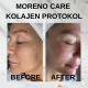 Collagen Film Yaşlanma Karşıtı Bakım